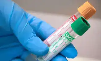 Злоупотребление доминирующим положением компанией Invivo Business в лабораторных услугах