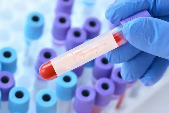 Новый вариант COVID-19 «Стратус» угрожает Казахстану: высокая заразность ставит под сомнение эффективность иммунитета у населения Атырау
