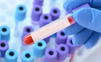 Новый вариант COVID-19 «Стратус» угрожает Казахстану: высокая заразность ставит под сомнение эффективность иммунитета у населения